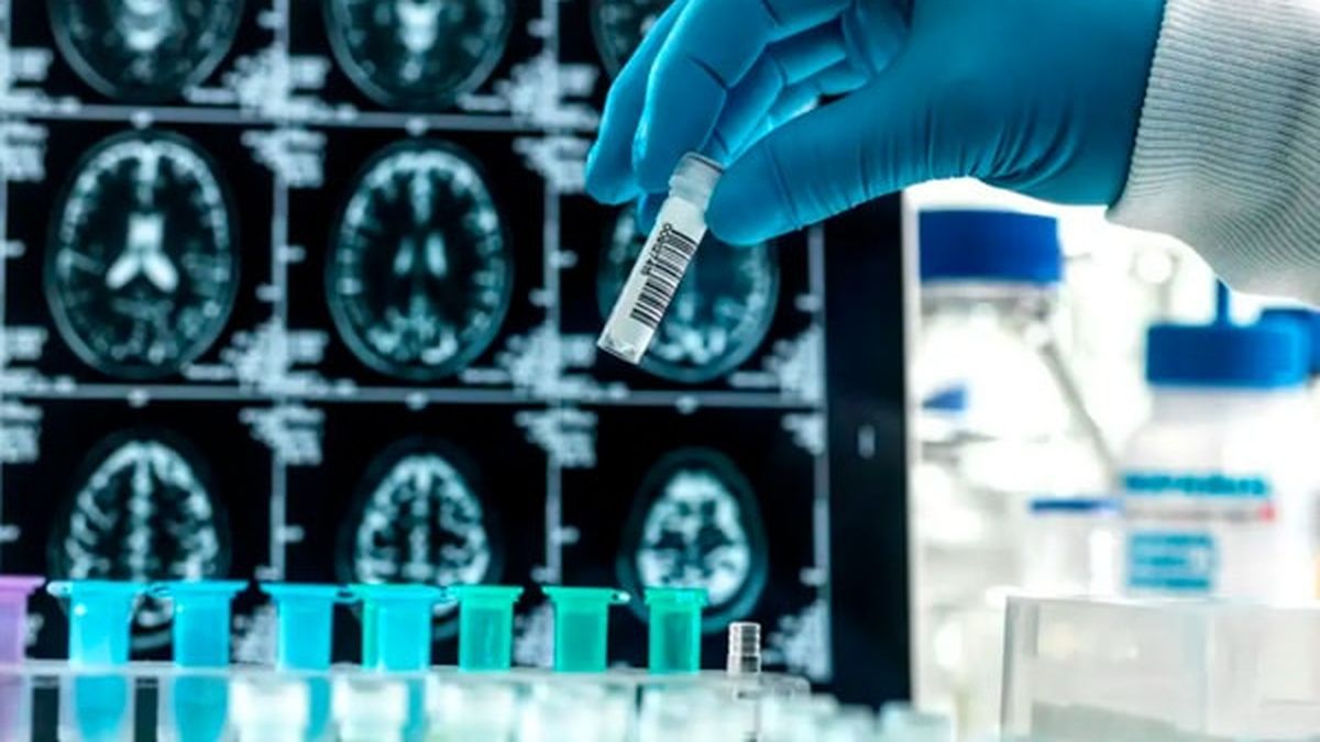 EEUU aprobó el segundo medicamento contra el Alzheimer: cómo funciona