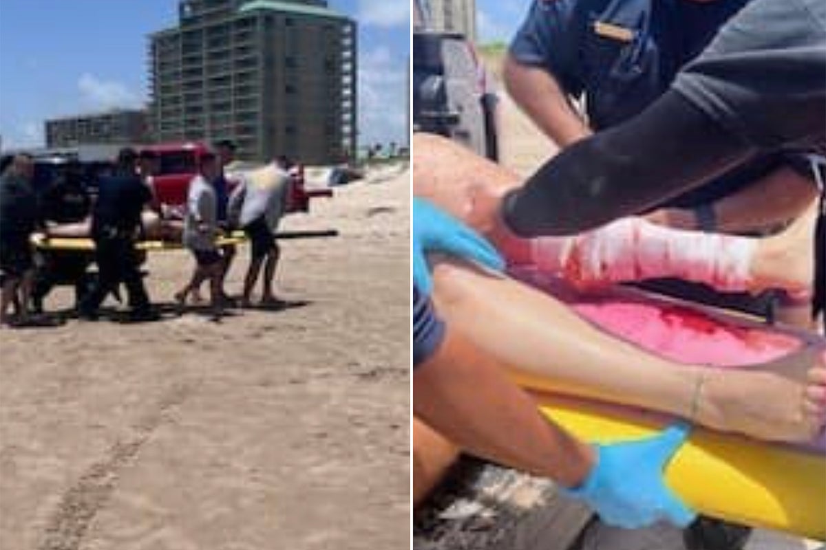 Cuatro heridos por ataques de tiburón en una isla de Texas