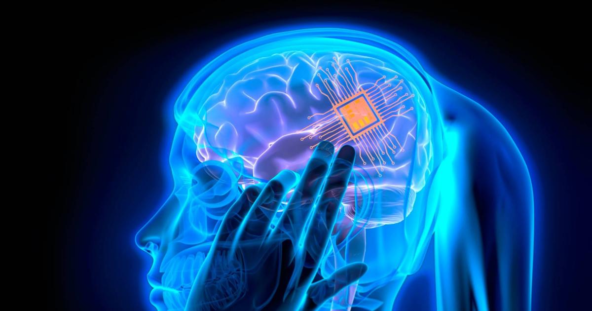 ¿ha-sido-elon-musk-el-primero-en-implantar-un-chip-en-un-cerebro-humano?