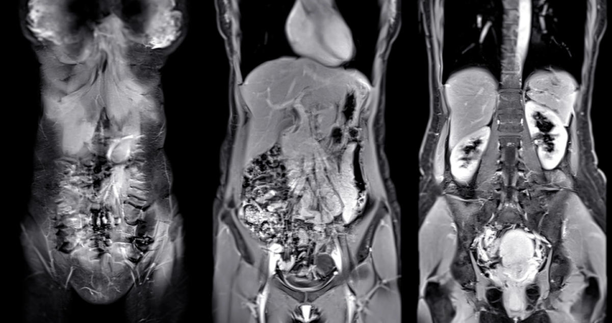 medicina-funcional:-la-ciencia-que-trata-la-raiz-de-las-enfermedades