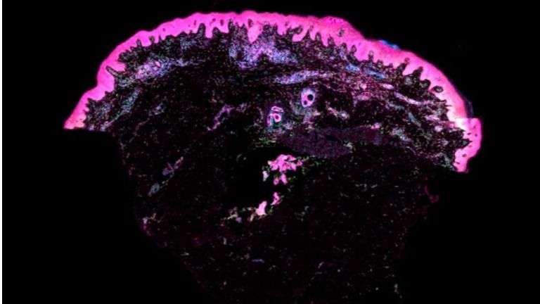 El primer mapa de la piel humana potenciará la medicina regenerativa