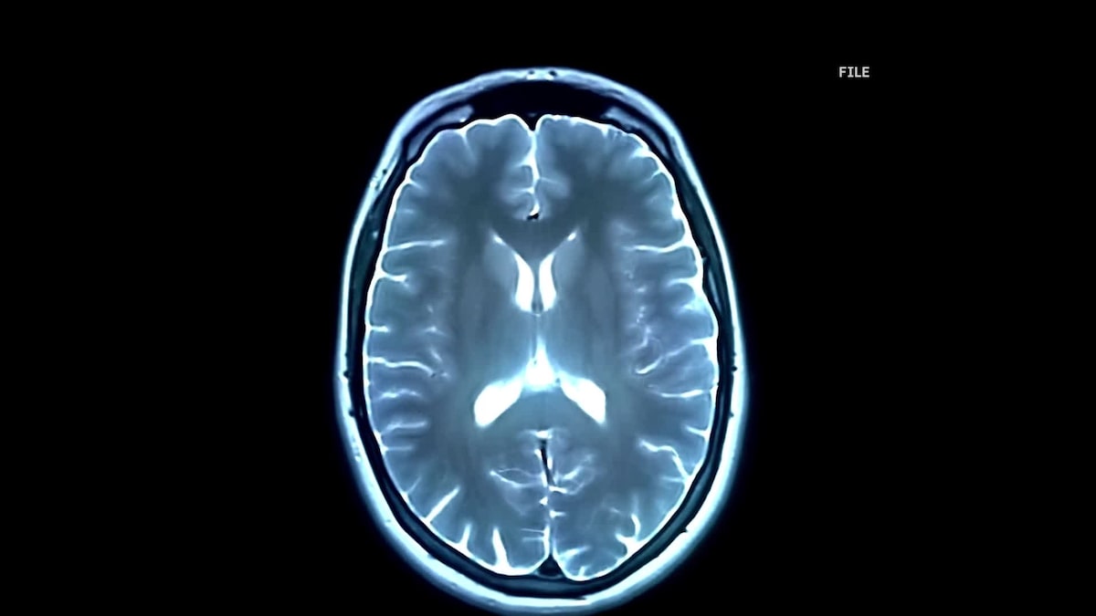 la-inteligencia-artificial-transformara-la-medicina,-pero-existe-un-unico-inconveniente