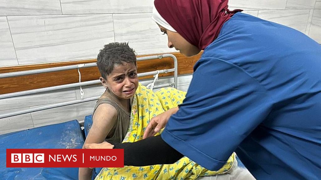 Israel – Gaza | “No hay cirujanos ni una sola ambulancia… Los heridos llegan a pie o en carros tirados por animales”: el relato de uno de los pocos médicos que quedan en Gaza  – BBC News Mundo