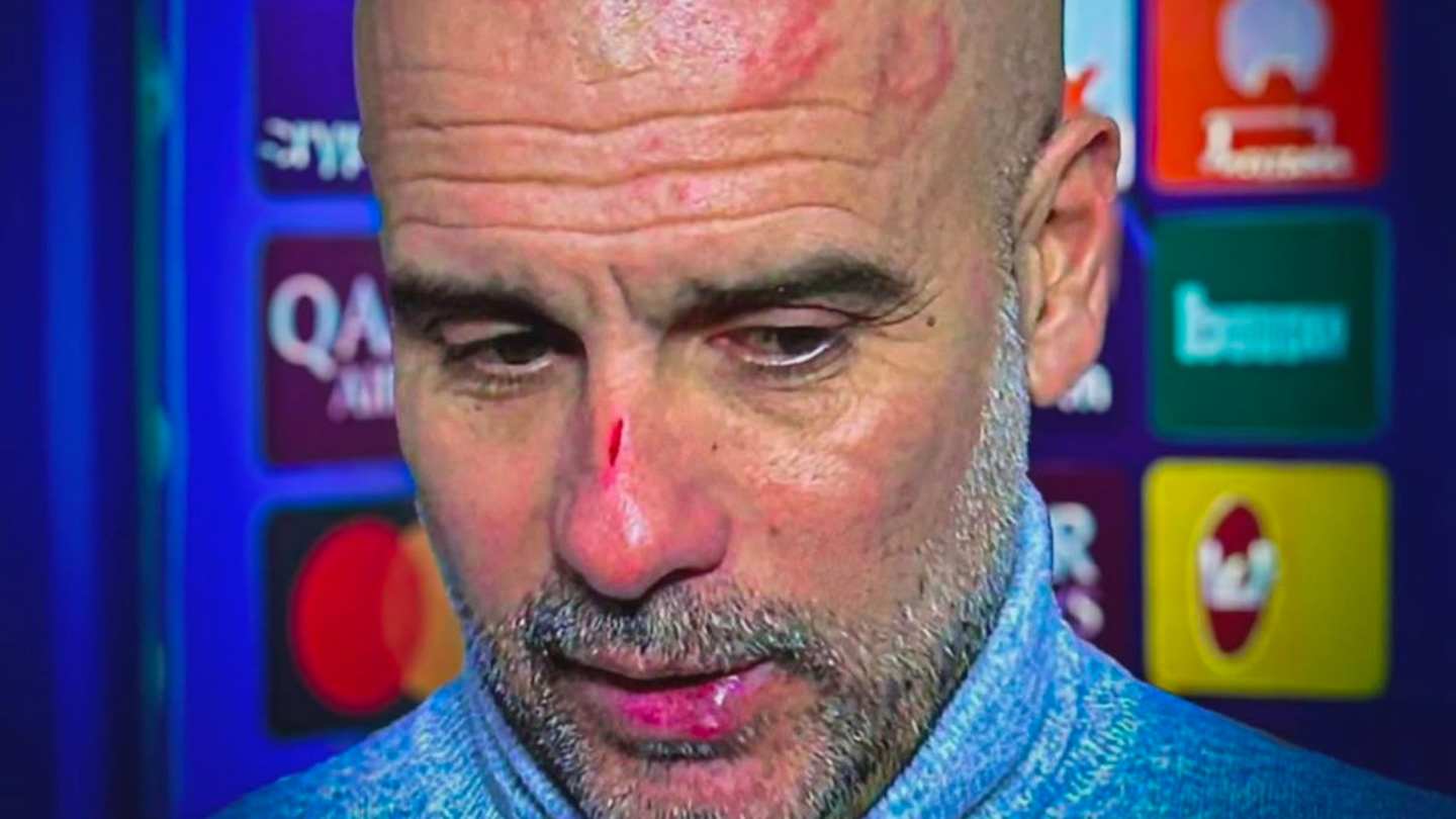 heridas-de-guardiola-levantan-rumores-sobre-posible-pelea-en-vestidor