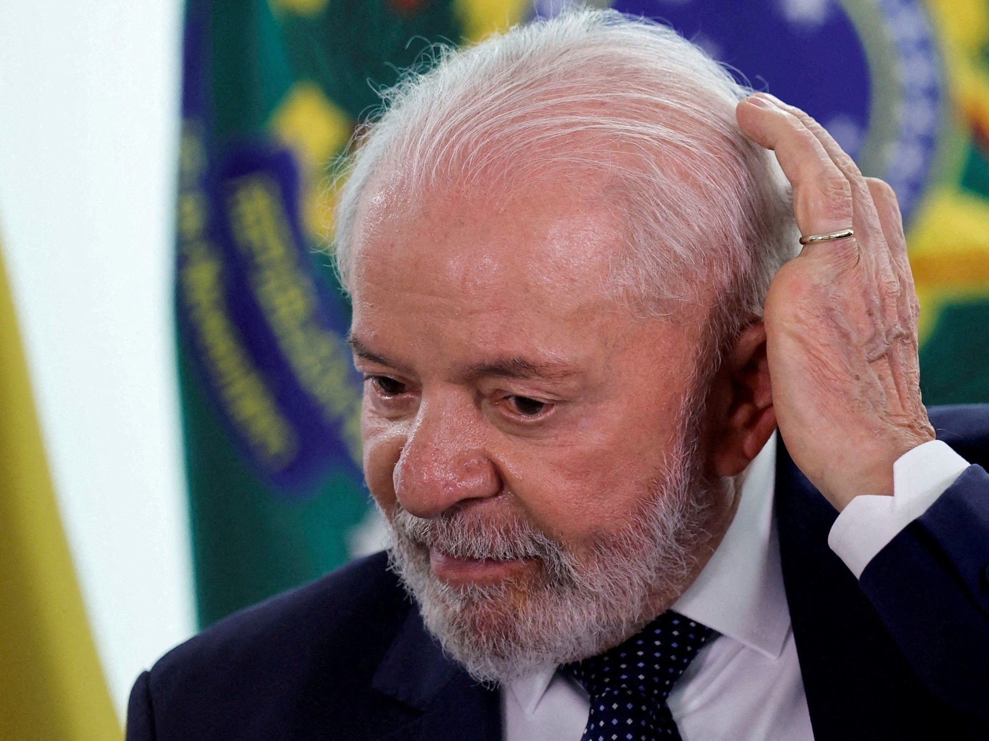 la-salud-del-presidente-de-brasil:-lula-da-silva-sera-sometido-a-una-nueva-operacion-para-detener-una-hemorragia-cerebral