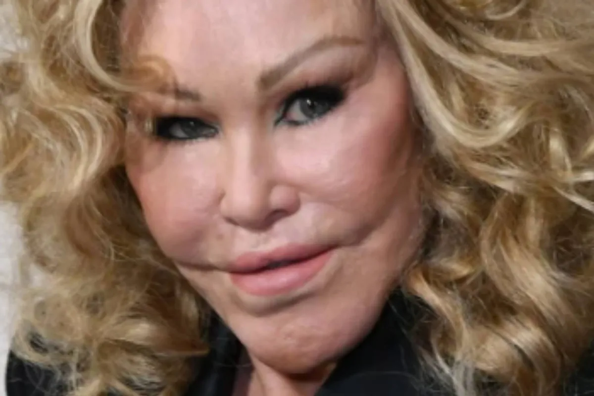 Muere Jocelyn Wildenstein, la millonaria &apos;Catwoman&apos; que se oper para parecerse a un felino