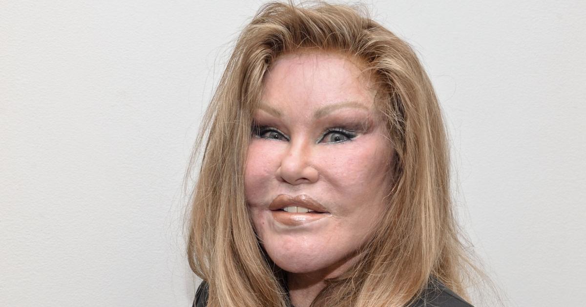 Jocelyn Wildenstein, la ‘Mujer Gato’, grabó un reality show antes de su muerte