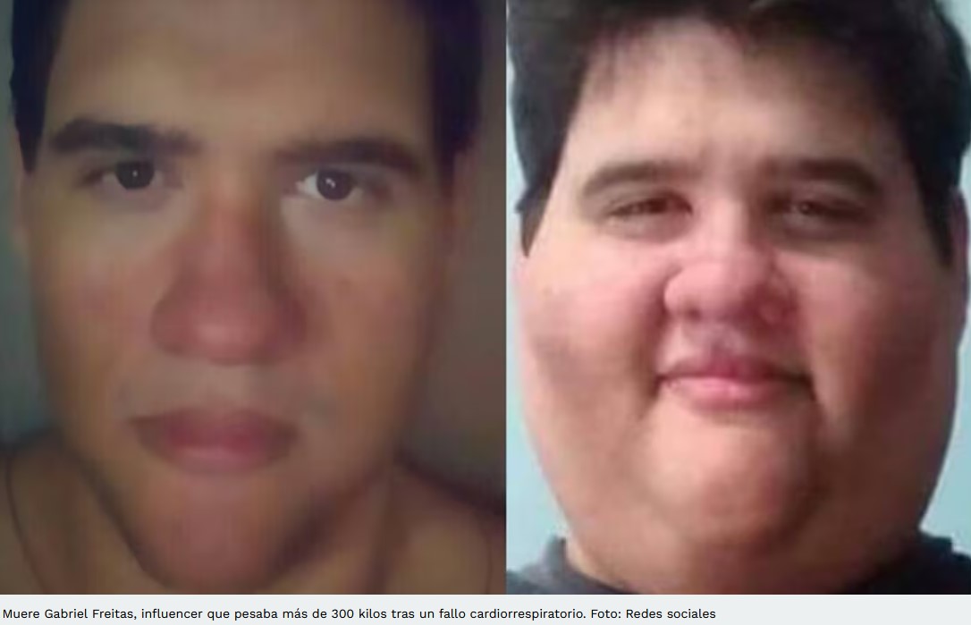 Muere influencer que pesaba más de 300 kilos tras un fallo cardiaco