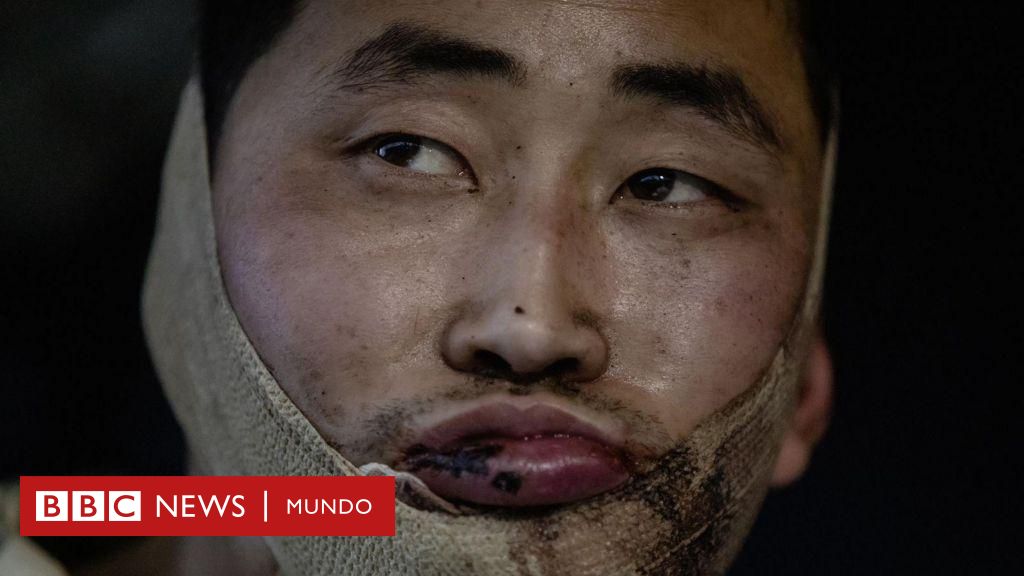 Ucrania asegura que capturó a dos soldados norcoreanos heridos en territorio ruso – BBC News Mundo