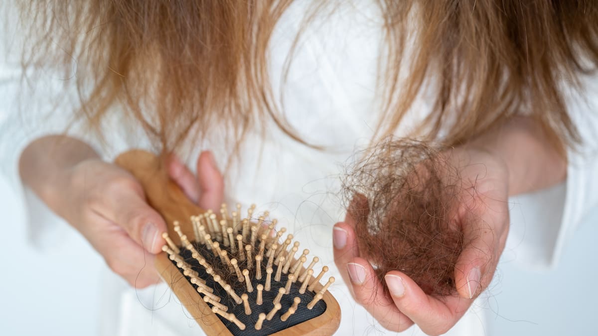 Estos son los casos en los que sí debería preocuparte la caída del pelo, según un experto en medicina capilar  | Mashup  | LOS40